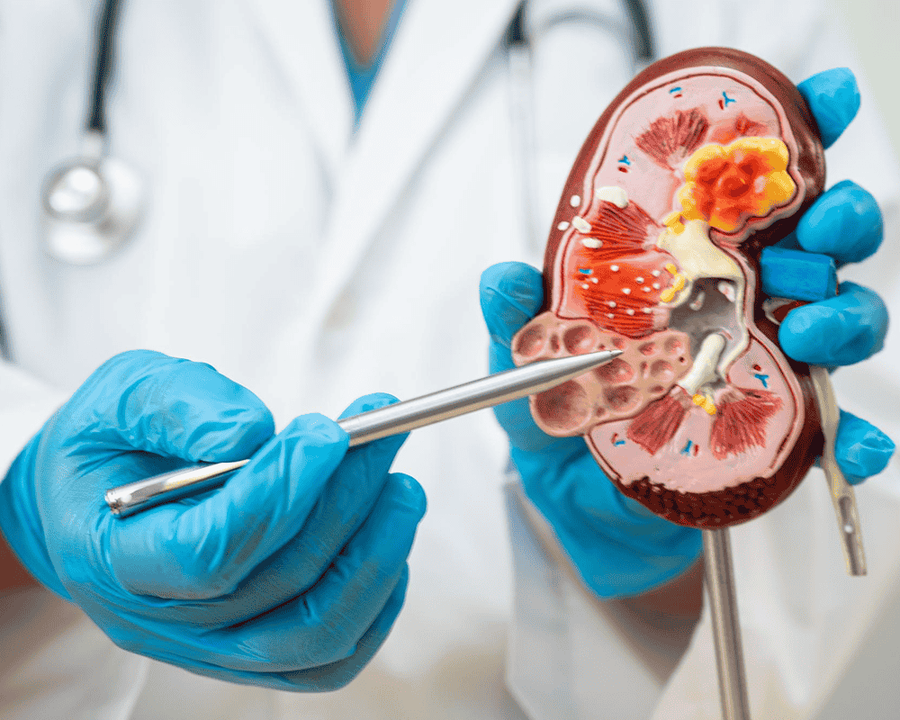 Nephrology Clinical Trials