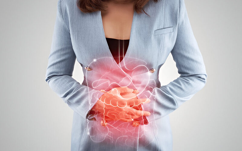 What Is Crohn's Disease