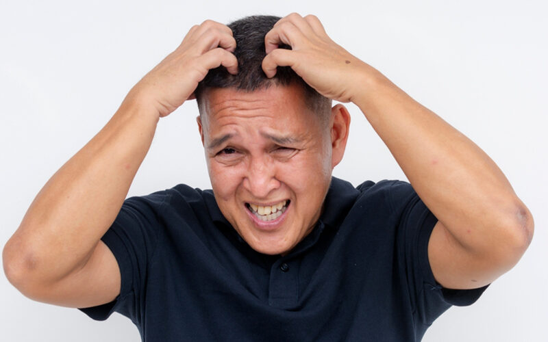 Scalp Dysesthesia