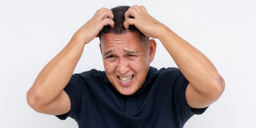 Scalp Dysesthesia
