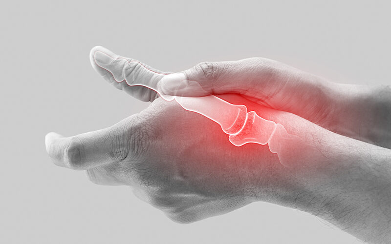 How is Seronegative Rheumatoid Arthritis Diagnosed